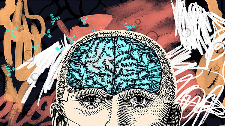 Man with brain exposed