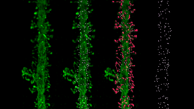 Locating the placement of tiny dendritic spines may hold important clues for learning and memory.
