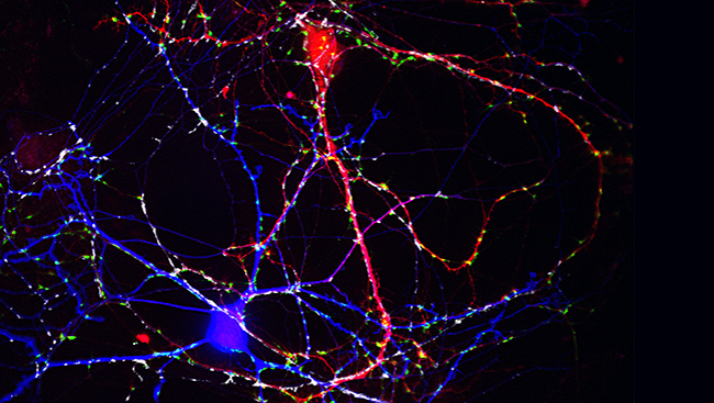 neurons in the brain neurons in the brain