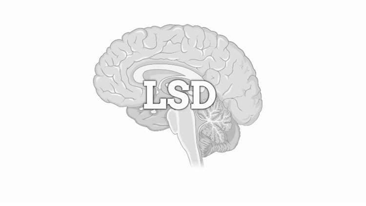 Brain with LSD