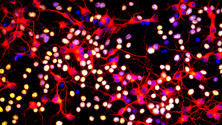 Oligodendrocytes 