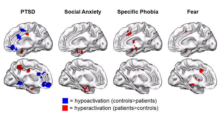 PTSD Imaging Studies