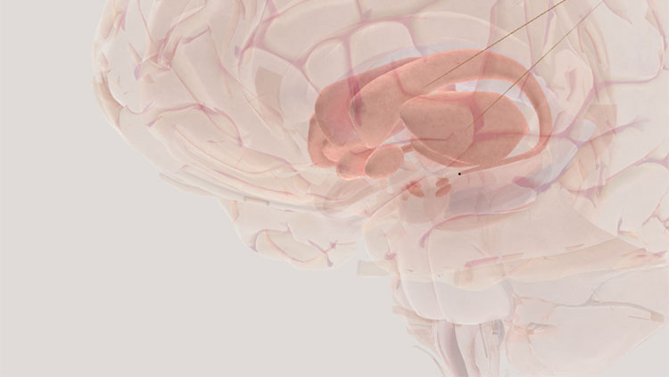 Basal ganglia