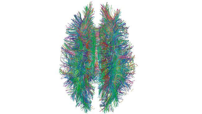 https://www.sfn.org/-/media/Brainfacts2/In-the-Lab/Tools-and-Techniques/Article-Images/Connectomics.png