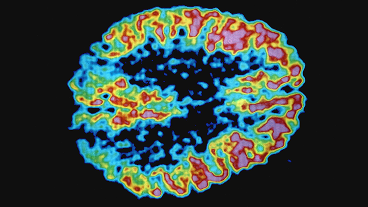 https://www.sfn.org/-/media/Brainfacts2/In-the-Lab/Tools-and-Techniques/Article-Images/What-Is-a-Circuit-Graphic-Story/PET-Scan.png