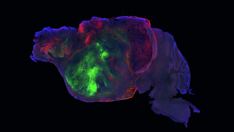 Human organoid image