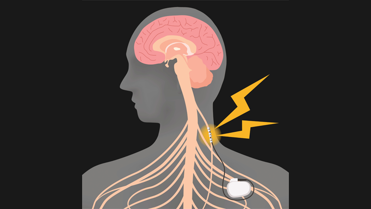 Illustration of human outline with brain inside of head