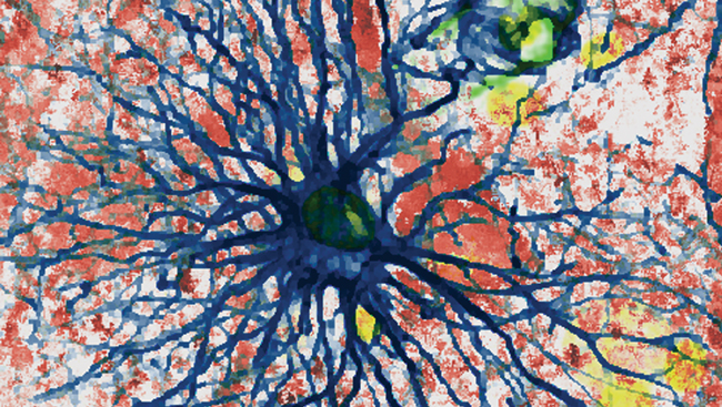 https://www.sfn.org/-/media/Brainfacts2/Thinking-Sensing-and-Behaving/Pain/Article-Images/Scientif-Default-astrocyte-II.jpg
