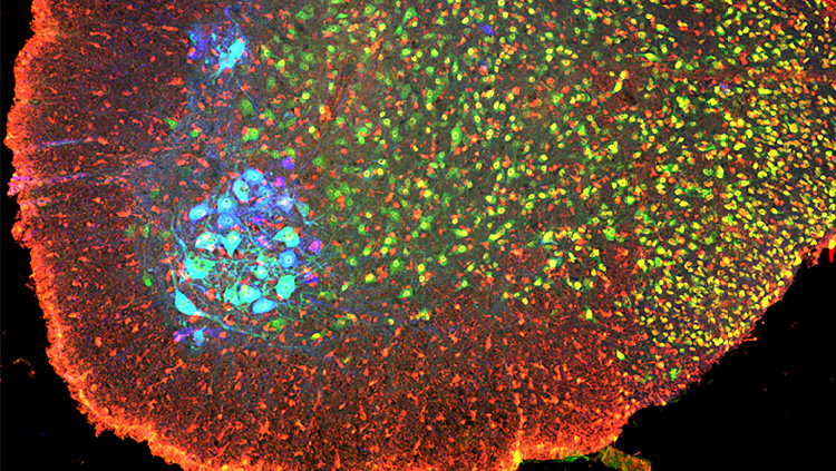 This image shows phosphorylated (inactivated) cofilin (red) in spinal cord. Phosphorylated cofilin is present at high levels in in a broad swathe of embryonic spinal neurons (green), including motor neurons (blue).