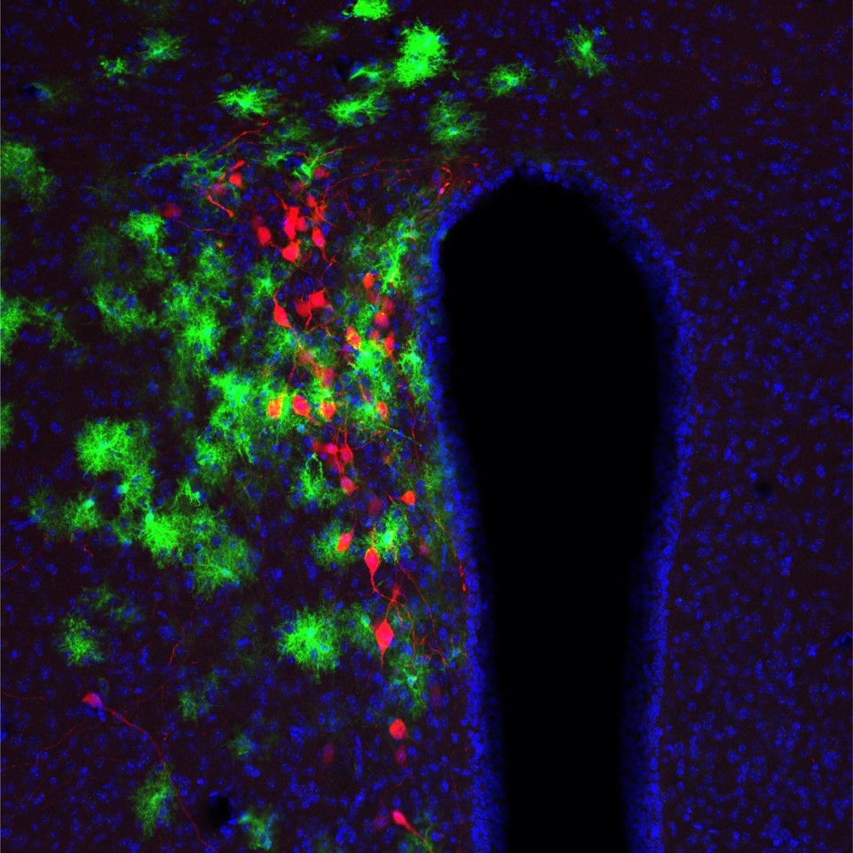 eN SiN Paraventricular nucleus of the hypothalamus