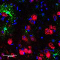 Virtually targeted astrocytes within the mouse nucleus accumbens