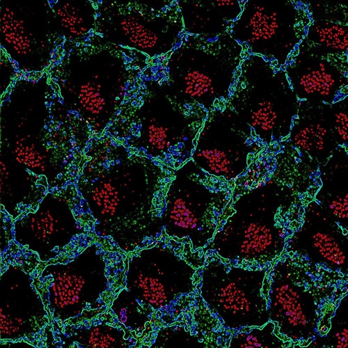 Ependymal cell basal bodies (red) are clustered in a patch just below the surface of ependymal cells outlined in green. Courtesy, with permission: Mirzadeh et al., 2010, JNeurosci, 30 (7) 2600-2610.