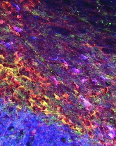 Immunostaining of dopaminergic neurons, which are known to be at most risk of death in Parkinson's disease. The image was processed to provide a watercolor effect. Courtesy, with permission: Murase et al., 2006, JNeurosci, 26 (38) 9750-9760.
