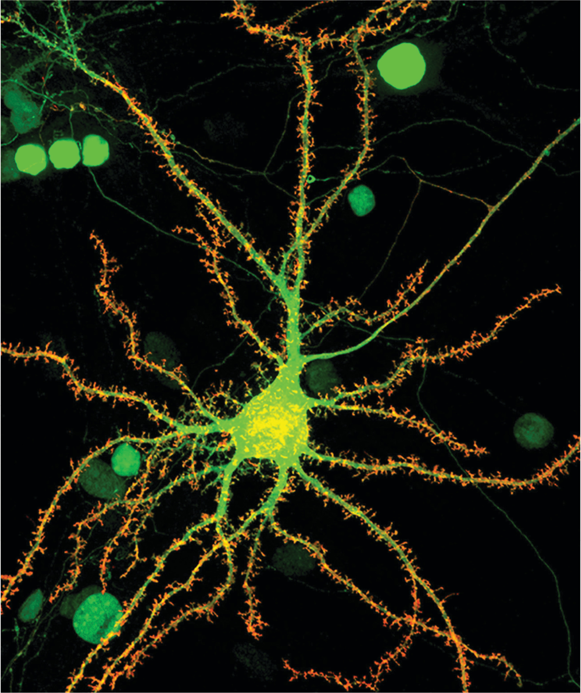 Hippocampal neurons (green) cultured from a mouse model overexpressing Neuroligin-1 (red). Modified from Chanda et al., 2017, JNeurosci, 37 (29) 6816-6836. Courtesy of Soham Chanda.