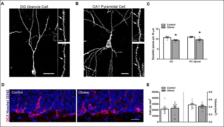 Immune Cells Destroy Healthy Brain Connections, Diminish Cognitive Function in Obese Mice