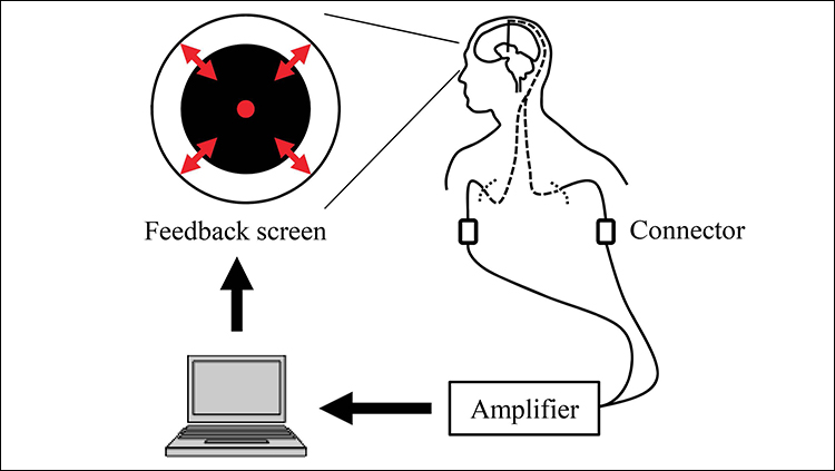 Real-Time Feedback Tames Parkinson’s Brainwaves