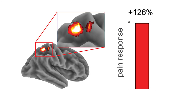 Poor Sleep Tonight Could Mean More Pain Tomorrow