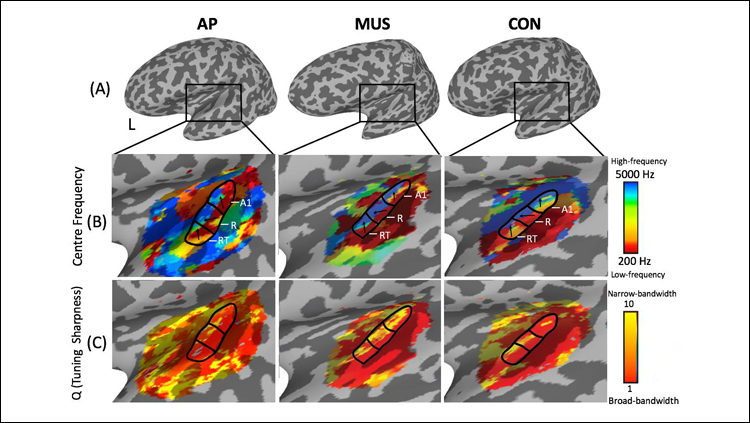 Pitch Perfect: Brain Differences Behind a Rare Musical Ability