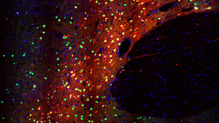 Manipulating Gene Expression in Neurons With CRISPR