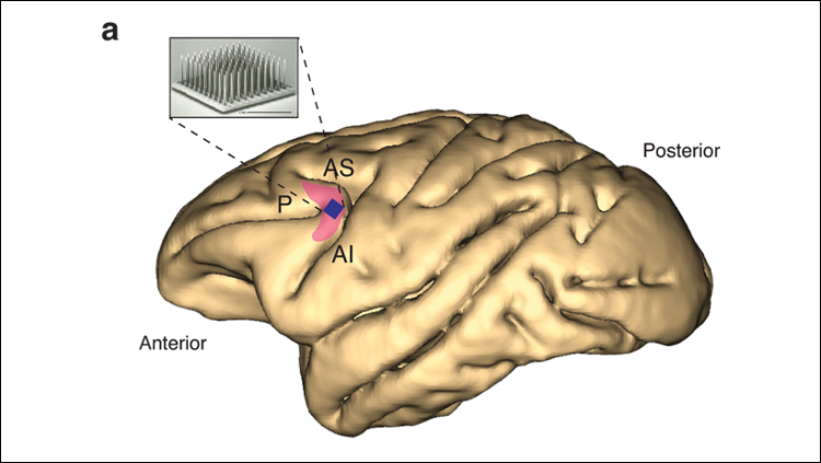 Ritalin Has No Effect on Primate Prefrontal Cortex