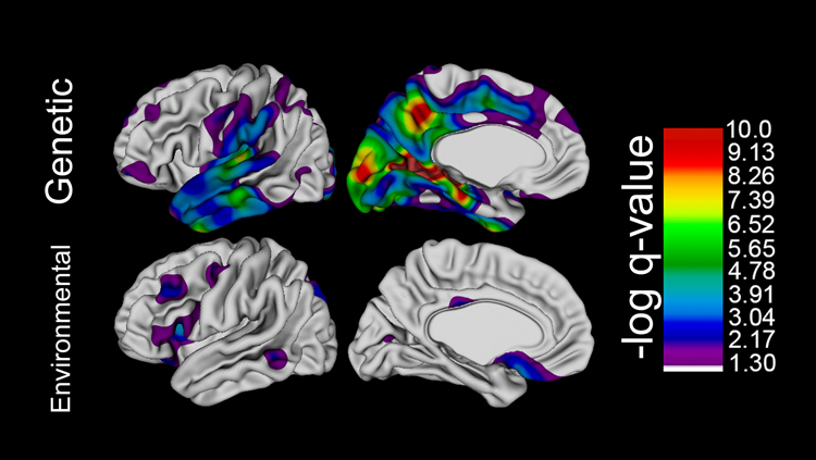 Genetic Factors Influence Human Brain Expansion