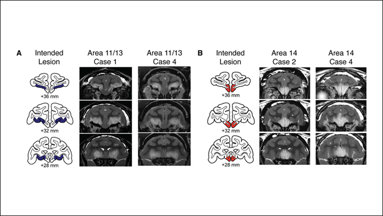 Orbitofrontal Cortex Regulates Threat Response in Monkeys