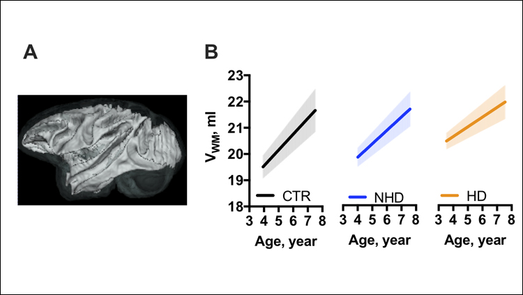 Alcohol Drinking Slows Brain Development in Monkeys