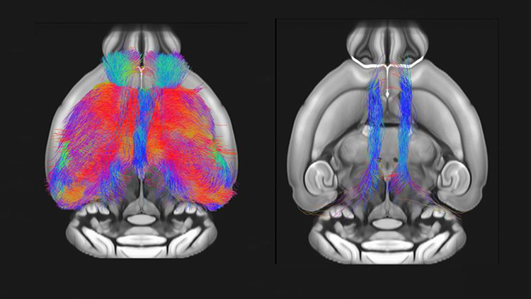 Autism Gene Linked to Brain and Behavior Deficits in Mice