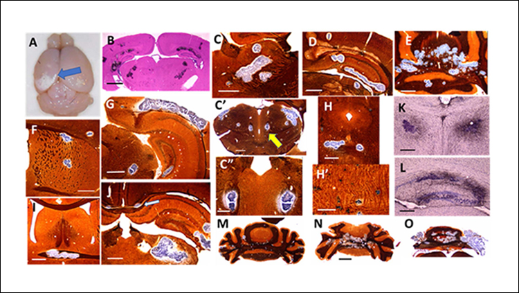 Long-Term Consequences of Zika Virus Infection