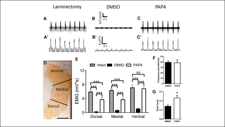 Diaphragm function was significantly restored by PAP4 following C2 hemisection. At eight weeks after injury, EMG recordings were assessed from uninjured, DMSO-treated hemisection, and PAP4-treated hemisection groups. EMG amplitudes were recorded at three subregions of the hemidiaphragm: dorsal, medial, and ventral regions (D). Both DMSO-treated and PAP4-treated groups were compared to intact (laminectomy-only) animals. Representative EMG traces from the ventral region of the diaphragm show that compared to laminectomy-only animals (A, A’), DMSO-treated rats (B, B’) had a significant decrease in inspiratory EMG burst amplitude at eight weeks after injury. Animals treated with PAP4 (C, C’) showed significant recovery of EMG amplitude following injury. Quantification of EMG recordings at the three hemidiaphragm regions (E). Ventral subregion EMG burst frequency was unaffected by PAP4 treatment (F). EMG duty cycle was increased by PAP4 (G). *p < 0.05. **p < 0.01. ***p < 0.001. ns, not significant p ≥ 0.05.