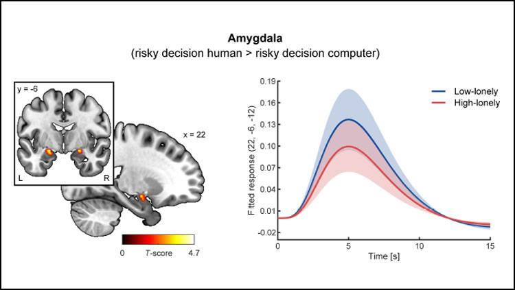 Loneliness Has a Different Neural Basis Than Social Anxiety 