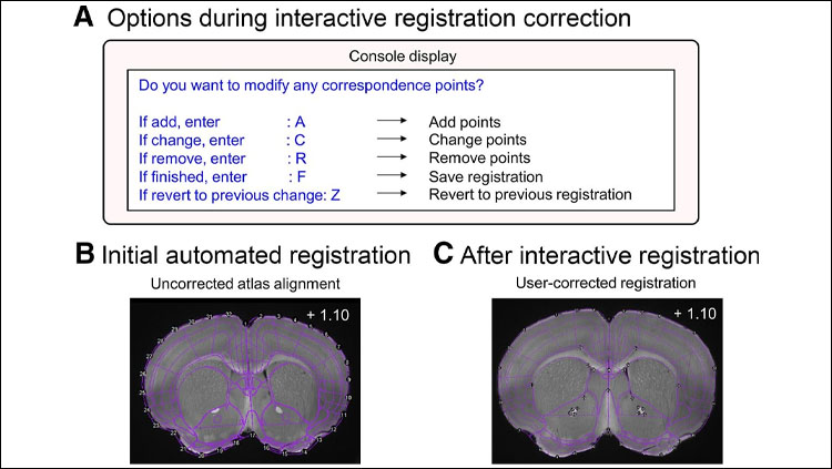 SMART: An Open-Source Extension of WholeBrain for Intact Mouse Brain Registration and Segmentation