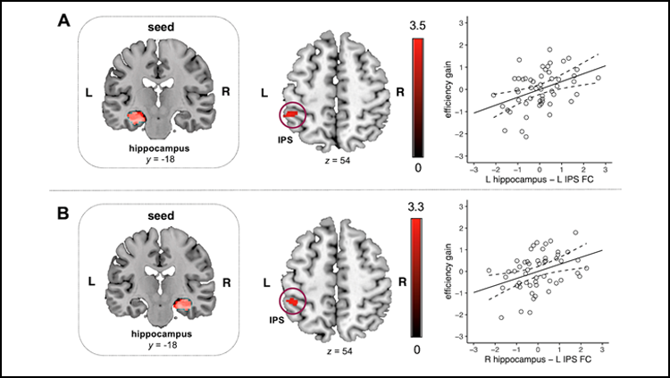 Figure from JNeurosci article entitled, "Foundational Number Sense Training Gains Are Predicted by Hippocampal–Parietal Circuits."