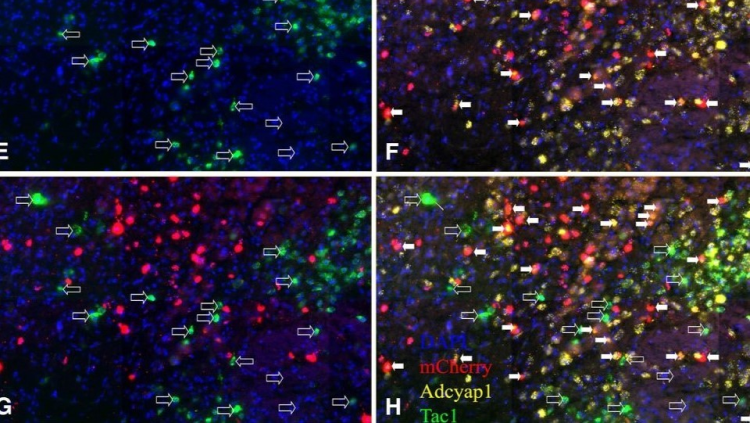 cover art for top articles of Nov and Dec on eNeuro Blog