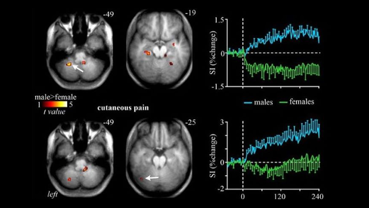 Re-examining the Mysterious Role of the Cerebellum in Pain