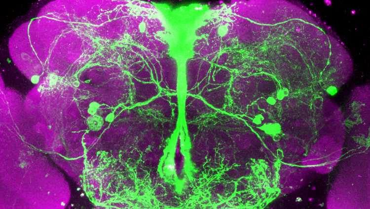 Image of fluorescent microscopy