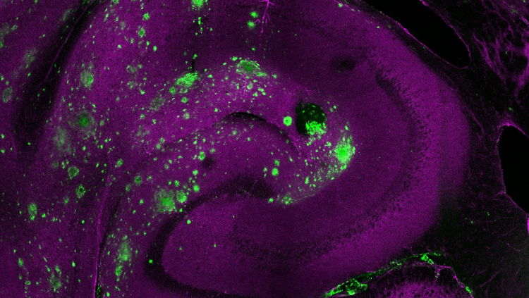 eNeuro banner, fluorescent microscopy