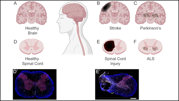 Figure from article in Journal of Neuroscience