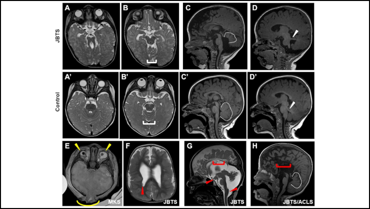 Figure of brain scans from a Journal of Neuroscience article