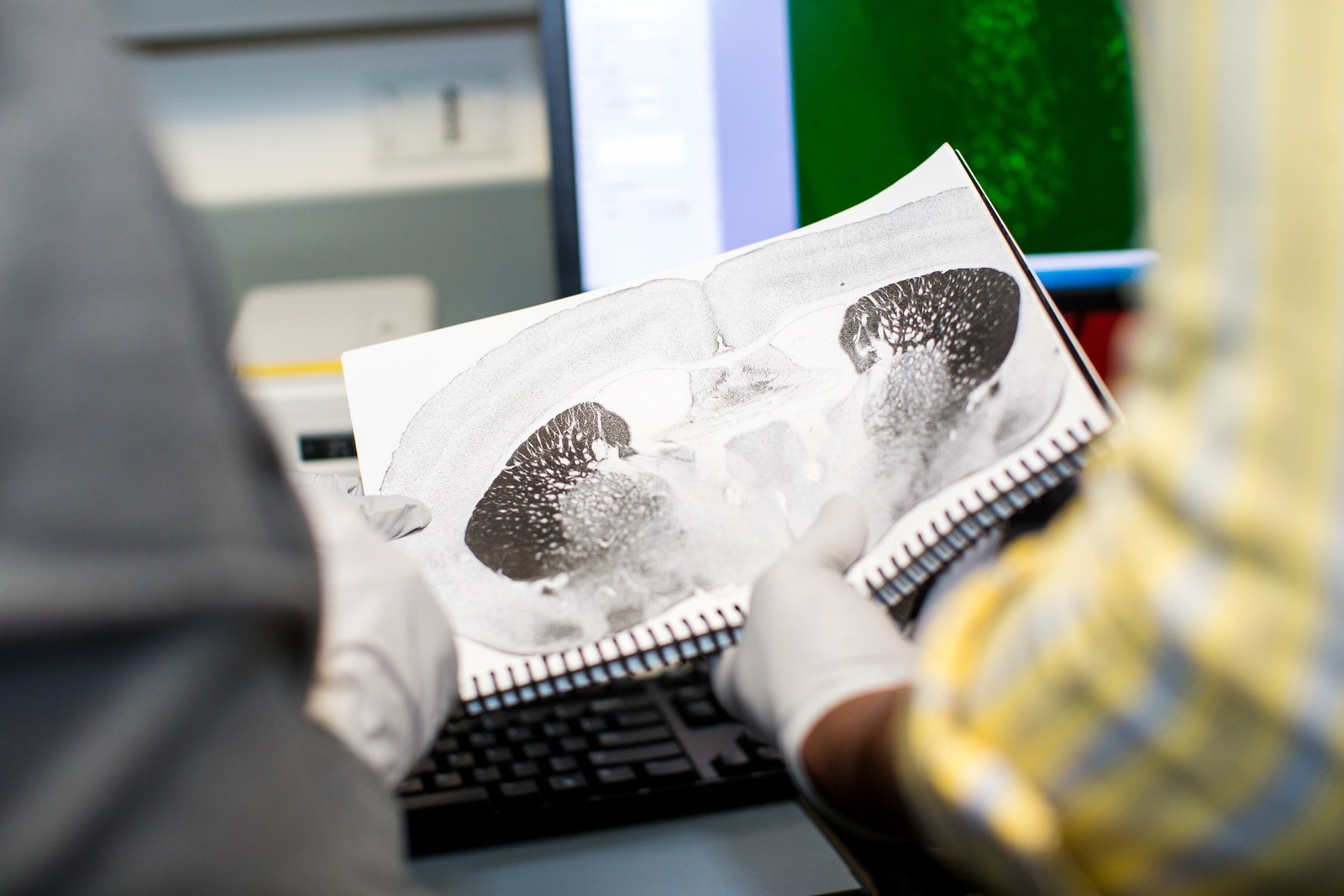 An image of a mouse brain taken from the optogenetics lab.