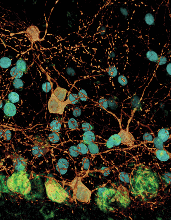 This confocal image depicts the morphological details of cerebellar molecular layer interneurons (MLIs).
