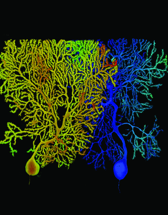 This image shows the dendritic trees of two Purkinje cells from wild-type (left, orange) and mutant mice lacking the alpha- and gamma-Protocadherin gene clusters 