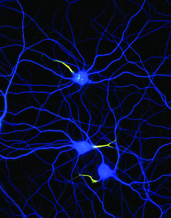 This image shows cultured hippocampal neurons labeled for dendrites (MAP2, blue), and for the axon initial segment (yellow is an overlay of neurofascin-186, green and β4-spectrin, red)