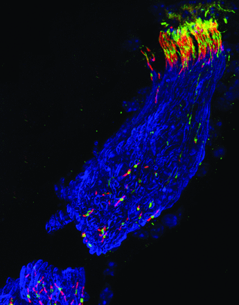 This image shows mature cochlear heminodes beneath hair cells and nodes of Ranvier within osseous spiral lamina in adult mouse auditory nerve.