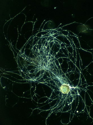 This image shows an isolated B8 motor neuron from an Aplysia californica buccal ganglion.