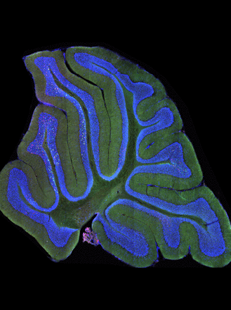 This confocal image of a sagittal section of the mouse cerebellum shows mossy fiber terminals (red, green, yellow) from Clarke's column neurons in the spinal cord, which synapse onto granule cells (blue) in the cerebellum
