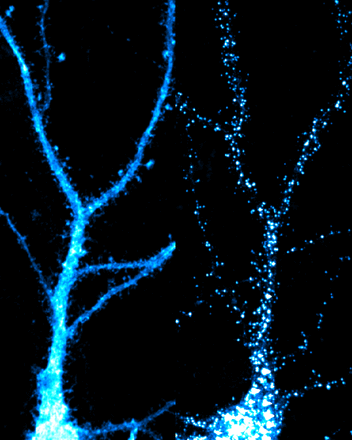 Confocal immunofluorescent image of two hippocampal neurons labeled for HA-tagged Nedd4-1, with and without AMPA treatment. In basal conditions (left), the E3 ubiquitin ligase Nedd4-1 is diffusely localized throughout the soma and dendrites.