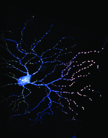 This image shows a retinal ganglion cell that was biolistically labeled in an adult mouse.