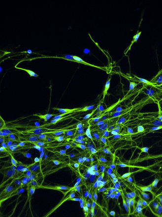 This image depicts cortical neurons derived from human induced pluripotent stem cells