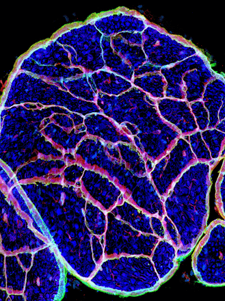 Confocal image of a section of sciatic nerve from an adult mouse lacking Gli-1, a transcription factor expressed in the endoneurial compartment of peripheral nerves independent of its canonical activator, the Hedgehog pathway.